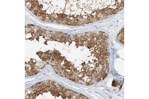 Immunohistochemical staining of human testis with ARD1B polyclonal antibody  shows distinct cytoplasmic positivity in seminiferus duct cells at 1:500-1:1000 dilution. (NAA11 anticorps)