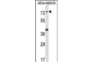 SYTL1 Antibody (Center) (ABIN656741 and ABIN2845964) western blot analysis in MDA-M cell line lysates (35 μg/lane). (SYTL1 anticorps  (AA 296-325))