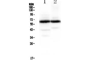 Western blot analysis of Synaptotagmin 1 using anti-Synaptotagmin 1 antibody . (SYT1 anticorps)