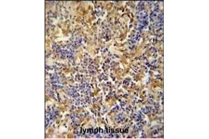 IBTK antibody (Center) (ABIN654688 and ABIN2844380) immunohistochemistry analysis in formalin fixed and paraffin embedded human lymph tissue followed by peroxidase conjugation of the secondary antibody and DAB staining.