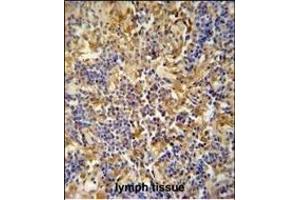 IBTK antibody (Center) (ABIN654688 and ABIN2844380) immunohistochemistry analysis in formalin fixed and paraffin embedded human lymph tissue followed by peroxidase conjugation of the secondary antibody and DAB staining. (IBTK anticorps  (AA 586-613))