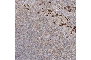Immunohistochemical staining of human pancreas with CLNK polyclonal antibody  shows strong cytoplasmic positivity in exocrine glandular cells at 1:200-1:500 dilution. (CLNK anticorps)