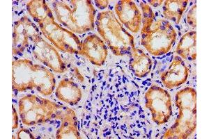 Immunohistochemistry of paraffin-embedded human kidney tissue using ABIN7159794 at dilution of 1:100 (MAST3 anticorps  (AA 1101-1309))