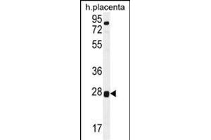 TOR2A Antibody (Center) (ABIN656112 and ABIN2850491) western blot analysis in human placenta tissue lysates (35 μg/lane). (TOR2A anticorps  (AA 194-221))