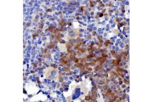 IHC analysis of IL3 using anti-IL3 antibody (ABIN7602653). (IL-3 anticorps  (AA 91-166))