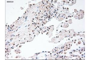 Image no. 1 for anti-Glial Fibrillary Acidic Protein (GFAP) antibody (ABIN1498436) (GFAP anticorps)