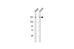 All lanes : Anti-COL11A1 Antibody (N-Term) at 1:2000 dilution Lane 1: A549 whole cell lysate Lane 2: Jurkat whole cell lysate Lysates/proteins at 20 μg per lane.