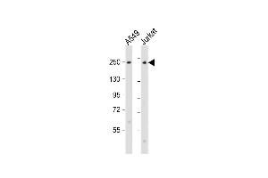 All lanes : Anti-COL11A1 Antibody (N-Term) at 1:2000 dilution Lane 1: A549 whole cell lysate Lane 2: Jurkat whole cell lysate Lysates/proteins at 20 μg per lane. (COL11A1 anticorps  (AA 41-75))