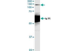 Immunoprecipitation of MCM2 transfected lysate using anti-MCM2 MaxPab rabbit polyclonal antibody and Protein A Magnetic Bead , and immunoblotted with MCM2 MaxPab rabbit polyclonal antibody (D01) . (MCM2 anticorps  (AA 1-904))
