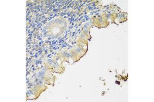 Immunohistochemistry of paraffin-embedded human appendix using CLN5 antibody (ABIN6133293, ABIN6138735, ABIN6138736 and ABIN6216682) at dilution of 1:150 (40x lens). (CLN5 anticorps  (AA 96-407))