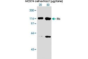 Western blot analysis in extracts from MOLT 4 cell using RB1 (phospho S612) monoclonal antibody, clone 3C11 . (Retinoblastoma 1 anticorps  (pSer612))