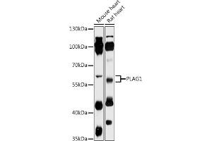 Western blot analysis of extracts of various cell lines, using PL antibody (ABIN7269418) at 1:1000 dilution.
