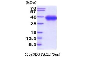 SDS-PAGE (SDS) image for Signaling Lymphocytic Activation Molecule Family Member 1 (SLAMF1) (AA 21-237) protein (His tag) (ABIN5854810) (SLAMF1 Protein (AA 21-237) (His tag))