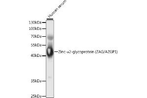 Western blot analysis of extracts of human serum, using Zinc-α2-glycoprotein (ZAG/Zinc-α2-glycoprotein (ZAG/)) antibody (ABIN6131435, ABIN6137386, ABIN6137387 and ABIN6221006) at 1:1000 dilution. (AZGP1 anticorps  (AA 21-298))