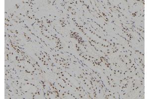 ABIN6277620 at 1/100 staining Human kidney tissue by IHC-P. (UBE2C anticorps  (C-Term))