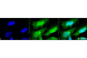 Immunocytochemistry/Immunofluorescence analysis using Rat Anti-HSF1 Monoclonal Antibody, Clone 10H8 . (HSF1 anticorps  (AA 378-395) (PE))
