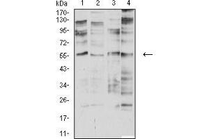 Western blot analysis using CHRNA2 mouse mAb against SK-N-SH (1), SH-SY5Y (2), membrane protein of C6 (3), and SW480 (4) cell lysate.