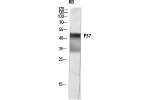Western Blot (WB) analysis of KB lysis using p57 antibody. (P57 (Ser238) anticorps)