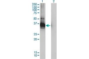 Western Blot analysis of LDLRAP1 expression in transfected 293T cell line by LDLRAP1 monoclonal antibody (M01), clone 4G4-D5. (LDLRAP1 anticorps  (AA 1-263))
