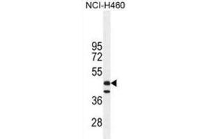 Western Blotting (WB) image for anti-Fibrinogen-Like 2 (FGL2) antibody (ABIN2996032) (FGL2 anticorps)