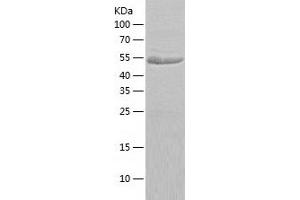 Western Blotting (WB) image for Glucose-6-Phosphate Dehydrogenase (G6PD) (AA 1-491) protein (His-IF2DI Tag) (ABIN7123105)