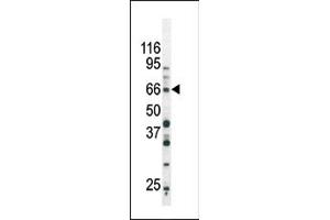 Image no. 1 for anti-SMAD, Mothers Against DPP Homolog 3 (SMAD3) (pSer213) antibody (ABIN358226) (SMAD3 anticorps  (pSer213))