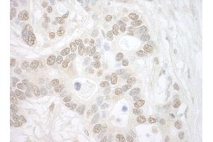 Immunohistochemistry (IHC) image for anti-Importin 4 (IPO4) (AA 900-950) antibody (ABIN7453530)