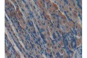 anti-Kallikrein 5 (KLK5) (AA 25-261) antibody