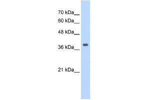 Tropomyosin 1 antibody used at 1. (Tropomyosin anticorps)