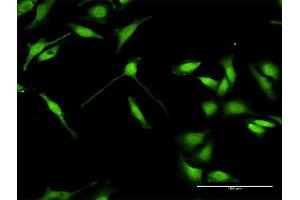 Immunofluorescence of purified MaxPab antibody to ELAVL4 on HeLa cell. (ELAVL4 anticorps  (AA 1-366))