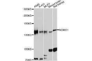 Western blot analysis of extracts of various cell lines, using NOMO1 antibody (ABIN5998361) at 1:7000 dilution. (NOMO1 anticorps)