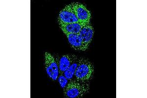 Confocal immunofluorescent analysis of HNF4A Antibody (N-term) (ABIN653385 and ABIN2842849) with MCF-7 cell followed by Alexa Fluor 488-conjugated goat anti-rabbit lgG (green). (HNF4A anticorps  (N-Term))