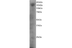 ABIN184630 staining (4µg/ml) of A431 lysate (RIPA buffer, 35µg total protein per lane). (DOCK1 anticorps  (C-Term))