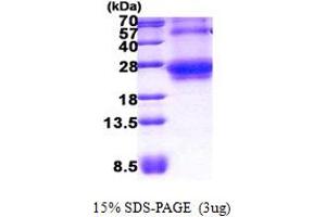 SDS-PAGE (SDS) image for Ras Homolog Gene Family, Member Q (RHOQ) (AA 1-202) protein (His tag) (ABIN5852957)