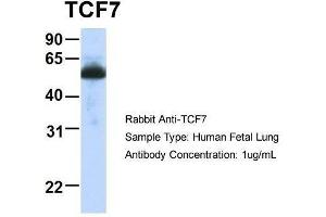 Host:  Rabbit  Target Name:  TCF7  Sample Type:  Human Fetal Lung  Antibody Dilution:  1. (TCF7 anticorps  (Middle Region))