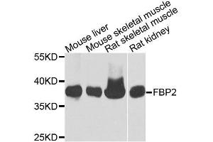Western blot analysis of extracts of various cell lines, using FBP2 antibody. (FBP2 anticorps  (AA 1-339))