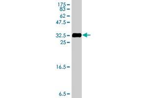 Western Blot detection against Immunogen (31.