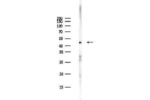 anti-Creatine Kinase, Muscle (CKM) (N-Term) antibody