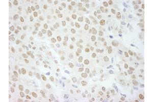 Immunohistochemistry (IHC) image for anti-Pleiotropic Regulator 1 (PLRG1) (AA 464-514) antibody (ABIN7449000) (PLRG1 anticorps  (AA 464-514))
