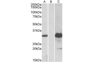HEK293 lysate (10ug protein in RIPA buffer) overexpressing Human KCTD11 with DYKDDDDK tag probed with ABIN625814 (1.