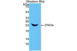 Western Blotting (WB) image for anti-Lipocalin 2 (LCN2) (AA 21-200) antibody (ABIN3206737) (Lipocalin 2 anticorps  (AA 21-200))