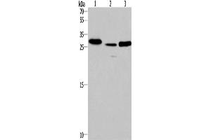 Western Blotting (WB) image for anti-Interleukin-1 Receptor-Associated Kinase 1 Binding Protein 1 (IRAK1BP1) antibody (ABIN2421755)