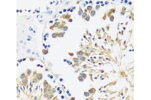 Immunohistochemistry of paraffin-embedded Mouse testis using CALM3 Polyclonal Antibody at dilution of 1:100 (40x lens). (Calmodulin 3 anticorps)