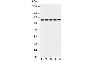 Western blot testing of Ku80 antibody and Lane 1:  Jurkat;  2: CEM;  3: Raji;  4: COLO320;  5: HT1080 cell lysate (XRCC5 anticorps  (C-Term))