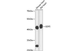 Western blot analysis of extracts of various cell lines, using GDF5 antibody (ABIN6133596, ABIN6141044, ABIN6141045 and ABIN6217062) at 1:3000 dilution. (GDF5 anticorps  (AA 350-450))