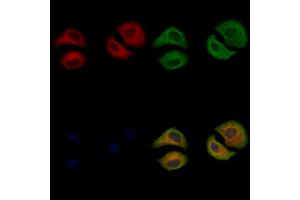 ABIN6263001 and ABIN6266814 staining Hela cells by IF/ICC. (LRAT anticorps  (Internal Region))