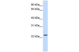 WB Suggested Anti-SCAND2 Antibody Titration: 0. (SCAND2 anticorps  (Middle Region))