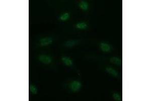 Image no. 4 for anti-CD163 (CD163) antibody (ABIN1497176) (CD163 anticorps)