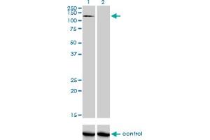 Western blot analysis of RNF111 over-expressed 293 cell line, cotransfected with RNF111 Validated Chimera RNAi (Lane 2) or non-transfected control (Lane 1). (RNF111 anticorps  (AA 1-108))