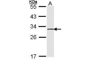 WB Image Sample (30 ug of whole cell lysate) A: A431 , 12% SDS PAGE antibody diluted at 1:1000 (PSMB4 anticorps)